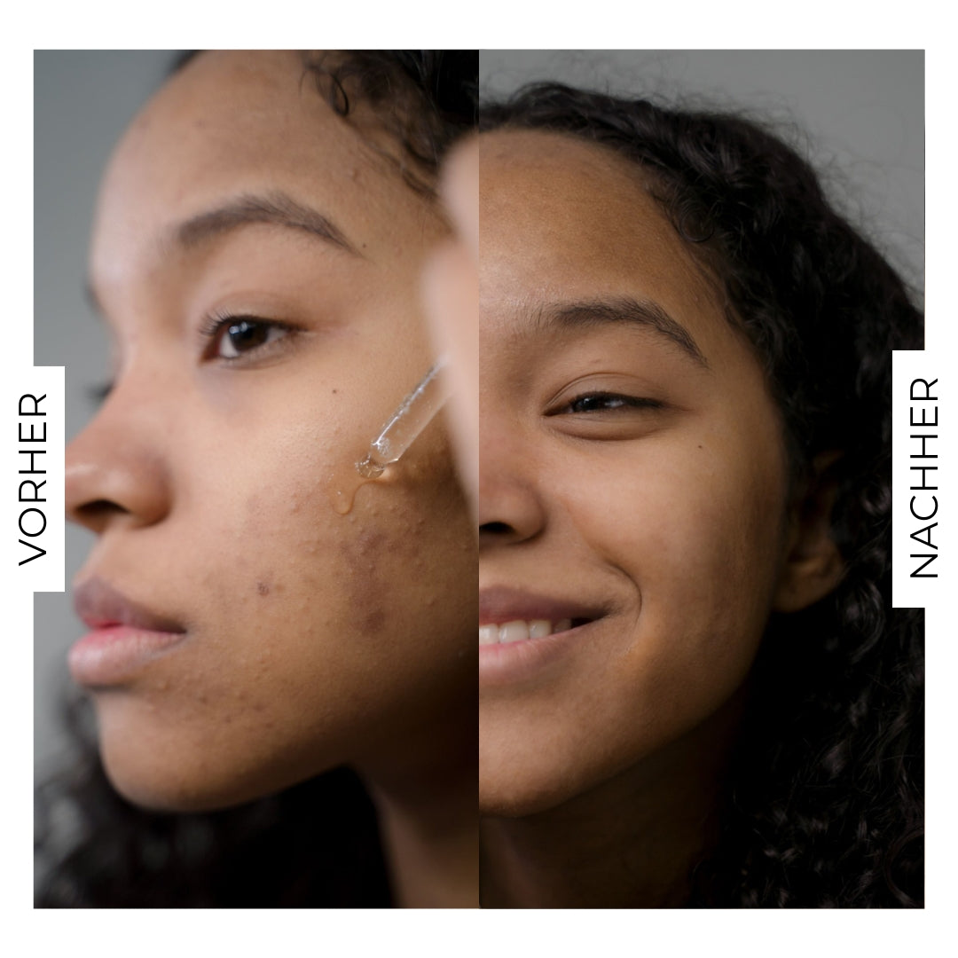 REINE HAUT - Niacinamide + Hyaluron Serum im SET