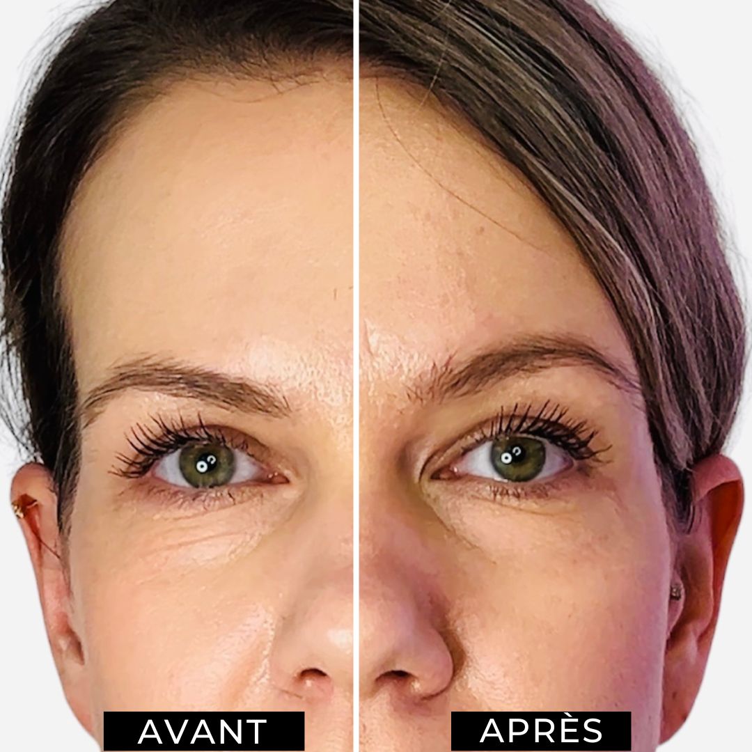 Crème anti-rides en 2 minutes avec EFFET IMMÉDIAT