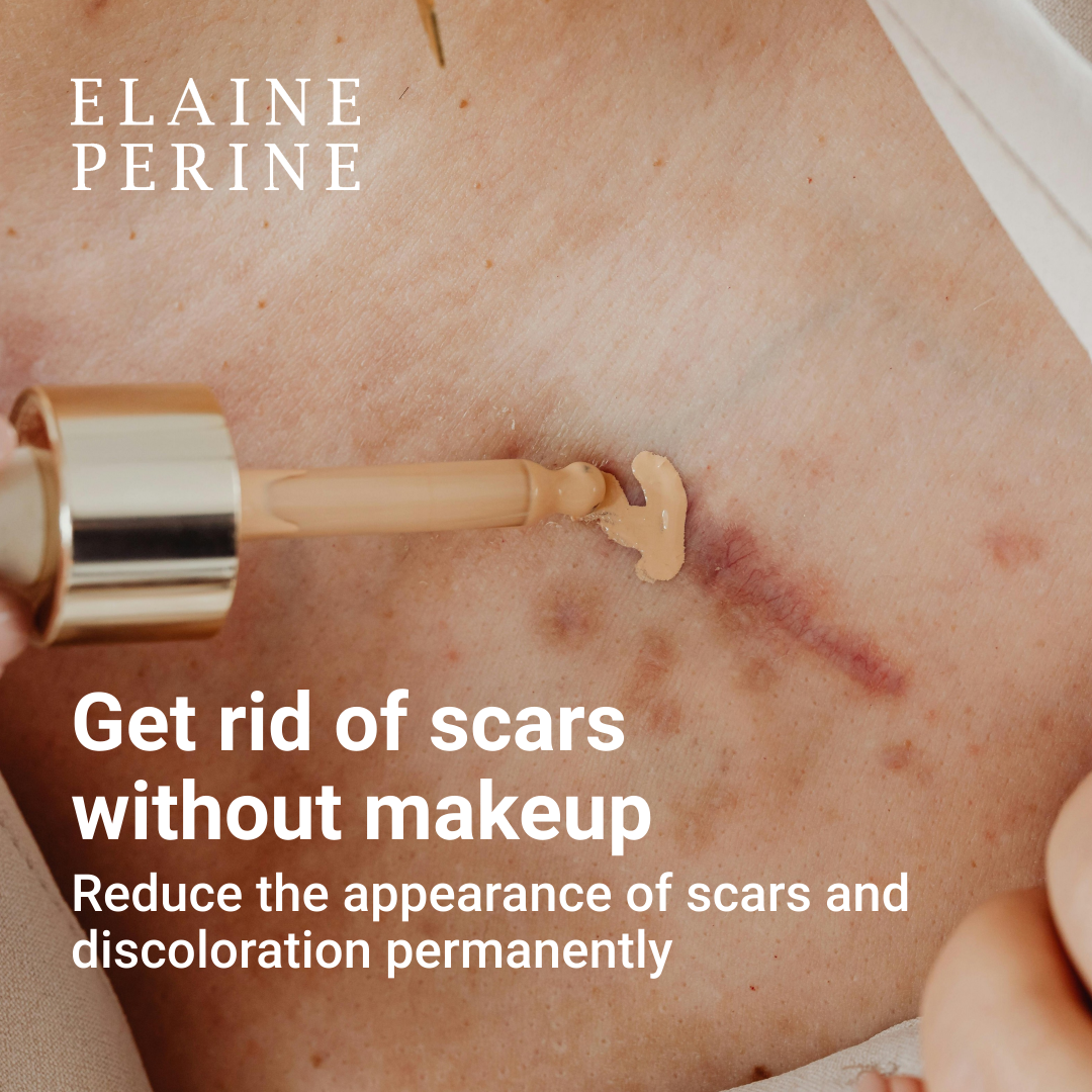 C-SECTION SCAR OINTMENT
