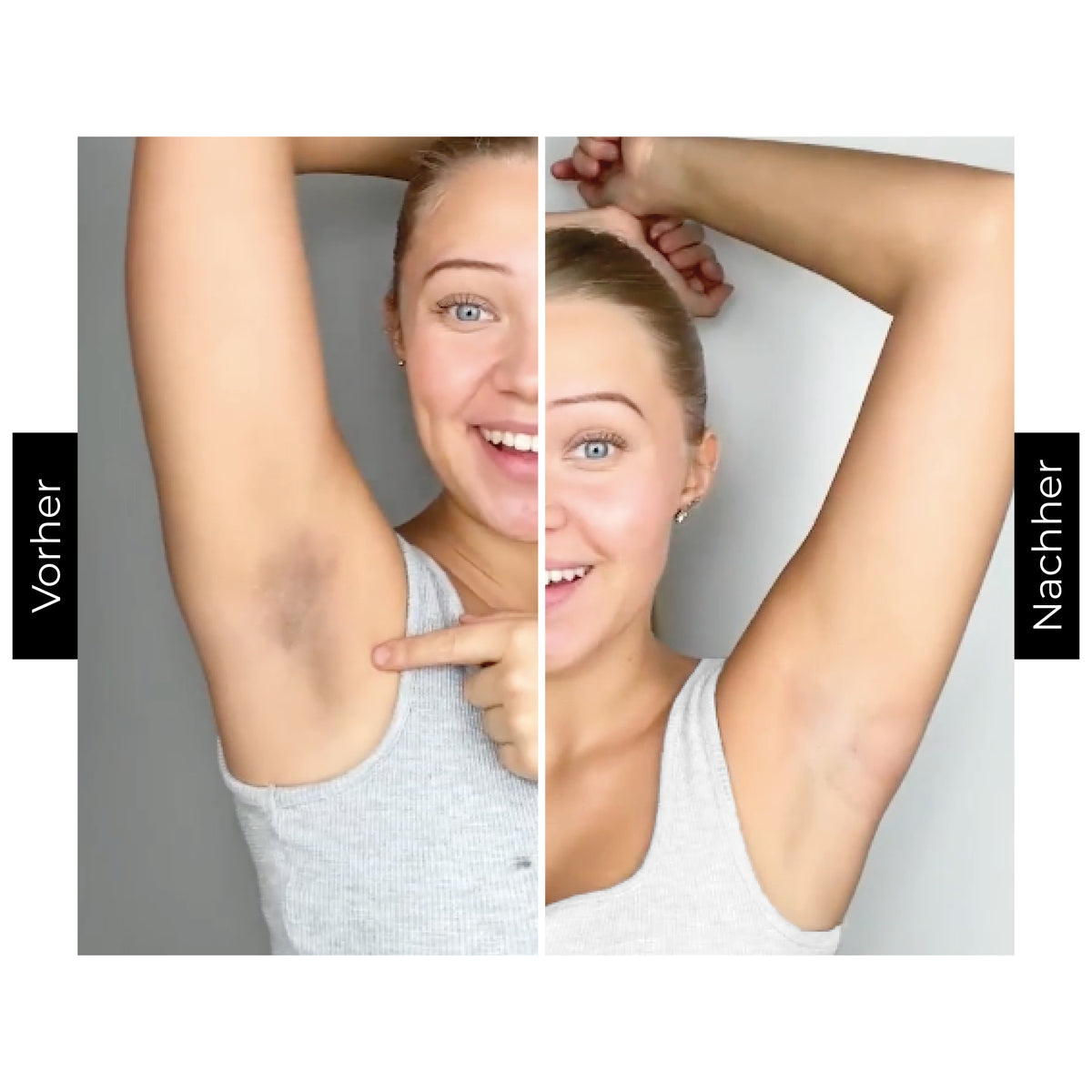Intim Bleaching Creme 
