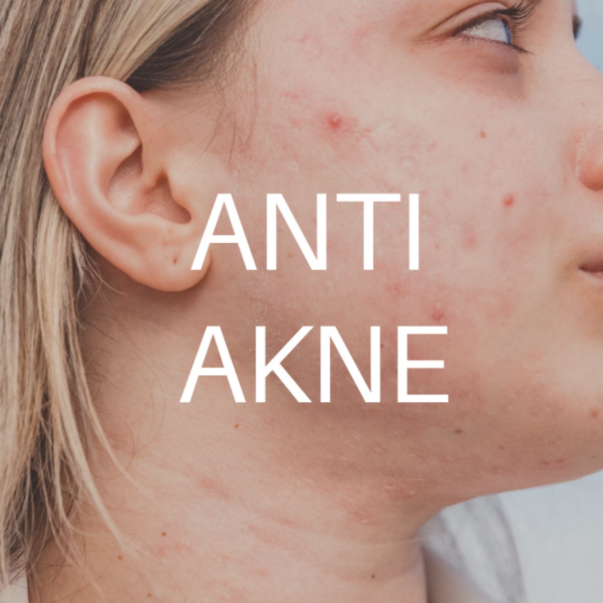 2% ÁCIDO SALICÍLICO+1% SERUM DE ZINC PRONTO AL ACNÉ