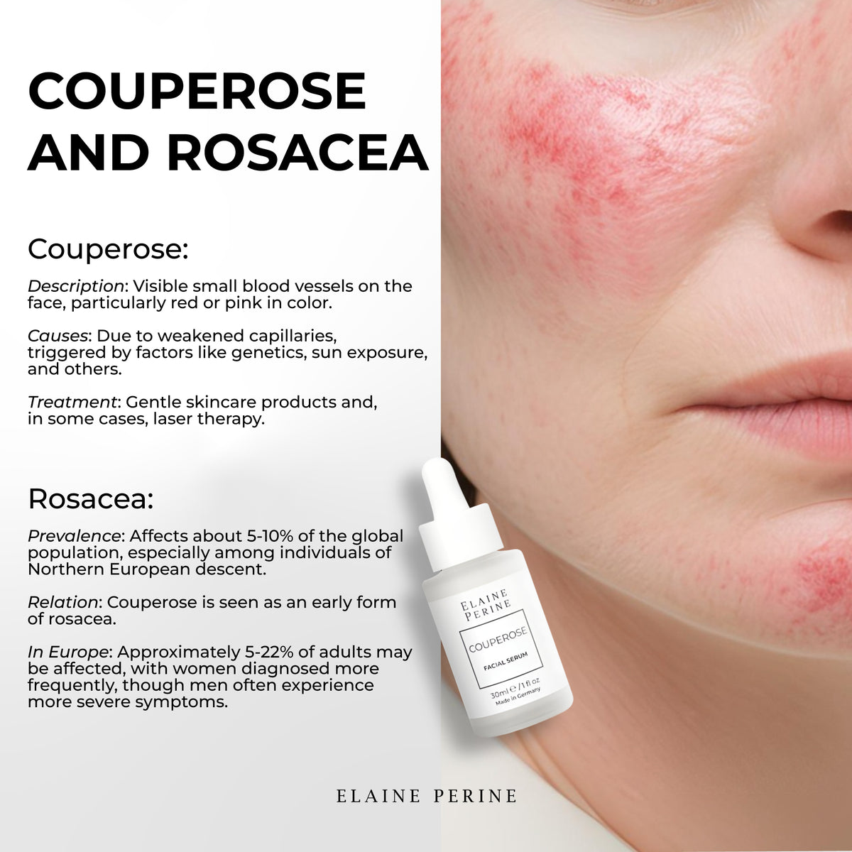Couperose Anti-Redness Serum 30ml