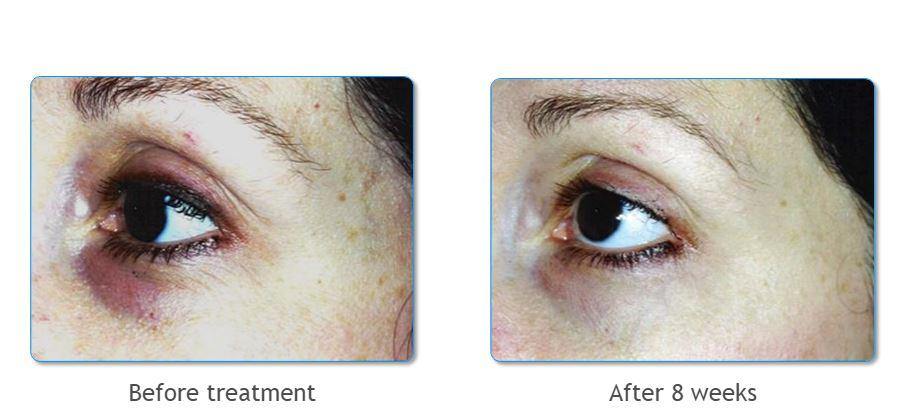 Anti Wrinkle Cream, Eyes - Lovely Eyes 0.5 oz