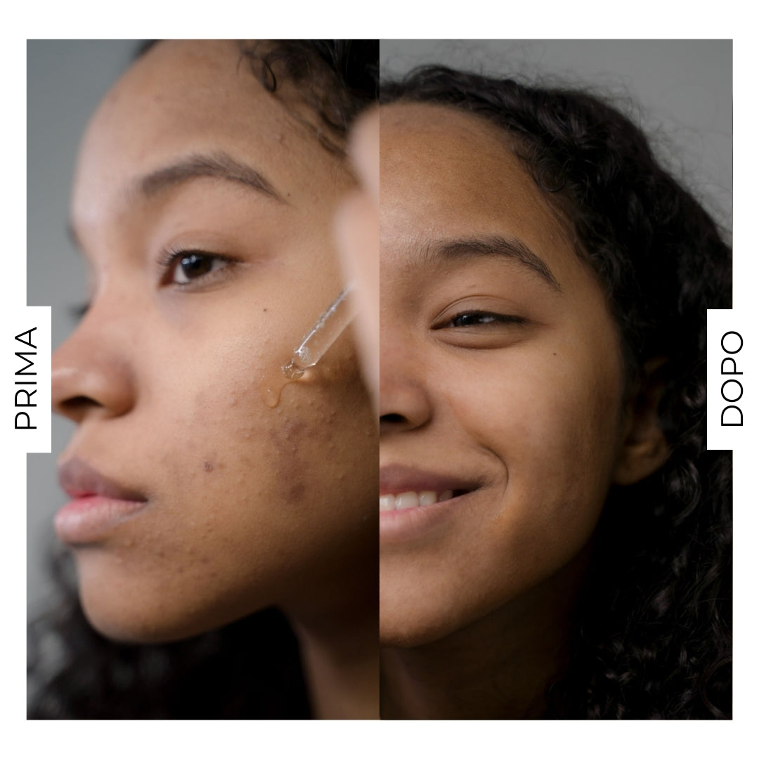 Niacinamide 10% + Zinco 1% Siero Viso