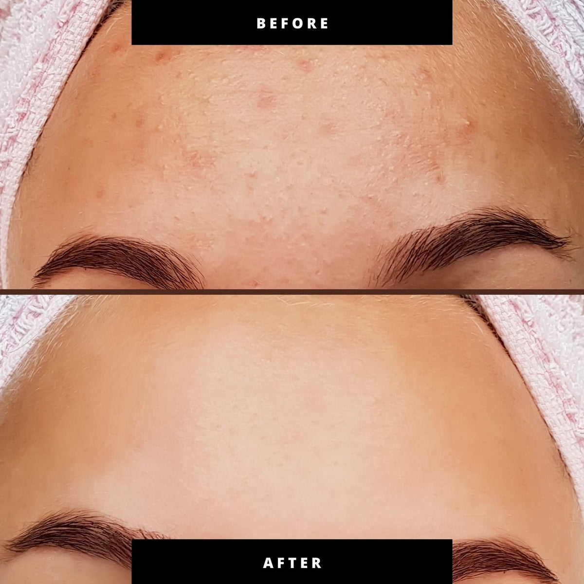 6+1 face care set